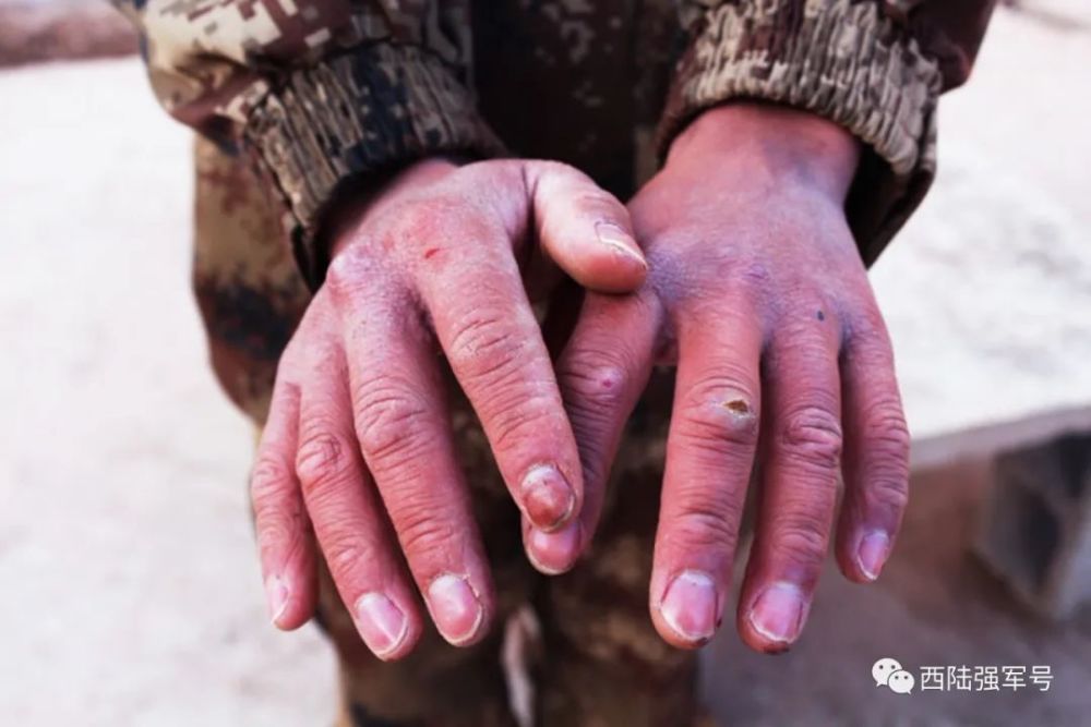 这位老兵的手如锉刀一般粗糙