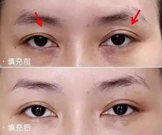 15岁出道,被网暴糊了16年,31岁的她终于硬核翻身