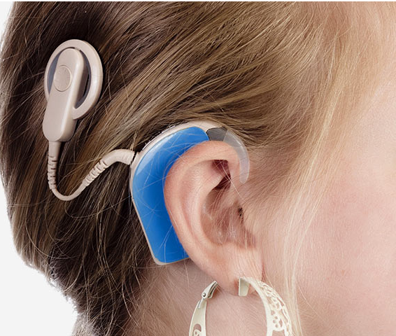 安庆助听器科普之助听器与人工耳蜗有什么区别?