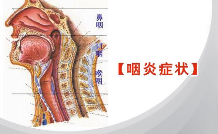 咽炎不舒服的位置图图片