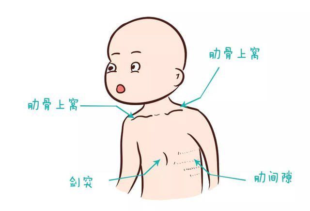 3,听肺部水泡音每次带宝宝去看病,医生都会拿听诊器听一听宝宝的