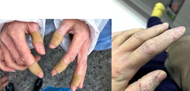 "疫"无反顾,她们披着最坚硬的"铠甲"守最柔软的心!