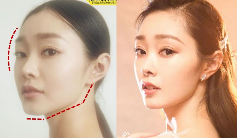 侧面颧,下颌形态