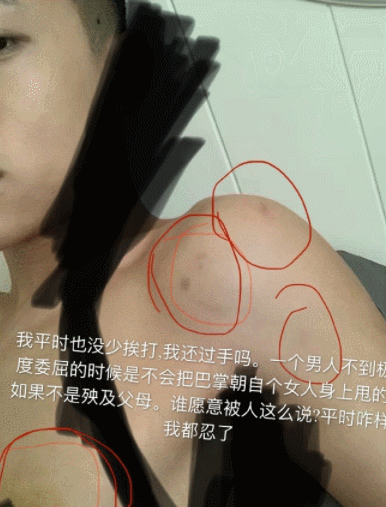 次惑小仙女称曾被佳帅家暴,对方立马晒出检查报告,好大一出戏