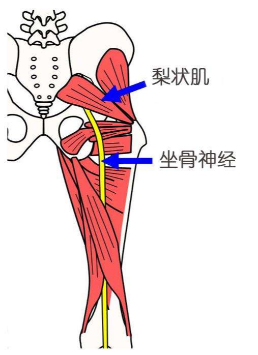 臀部腰部偶爾疼痛,可能是梨狀肌綜合徵,做這些瑜伽動作可以緩解