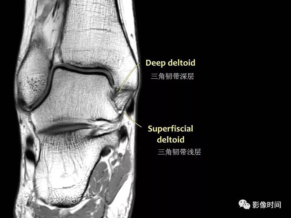 精美课件:踝关节 mri 系统讲座