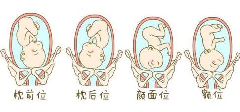 怀孕后,2种"坐姿"孕妈不能有,容易造成胎位不正