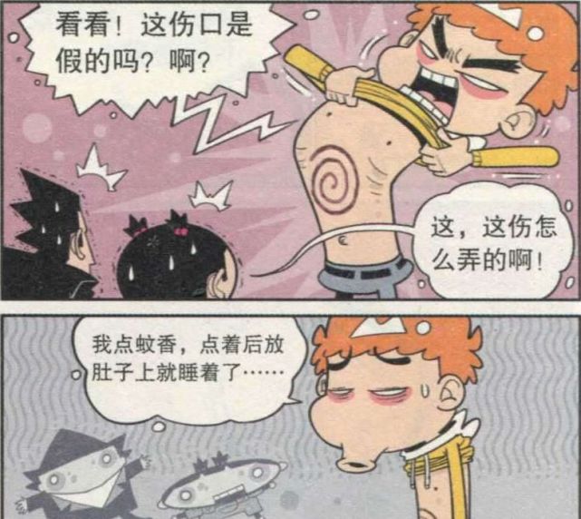 爆笑一刻:阿衰肚子疼,居然是晚上把蚊香放自己肚子上,被烧了一个印