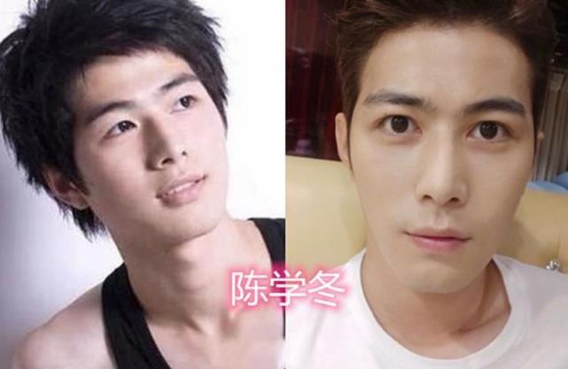 男星割过双眼皮前vs后罗志祥变化最大而许凯帅出新高度