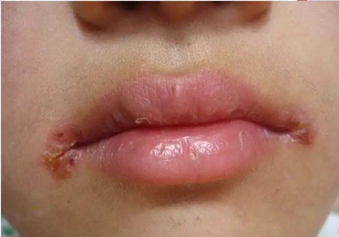 唇四白中的四不是指数字,而是指四方的意思.