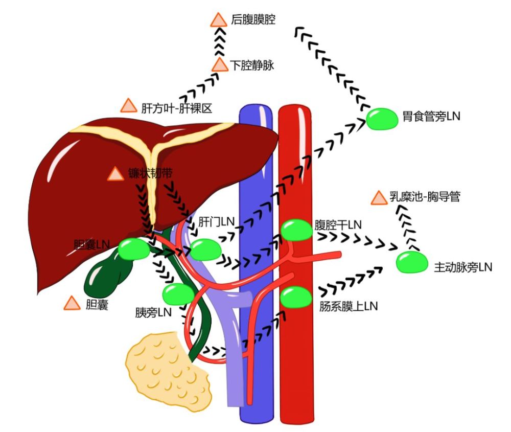 3張手繪圖教你讀懂肝臟淋巴迴流