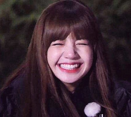 lisa为何总是"捂嘴笑"?看到她张口大笑的样子,好像明白了