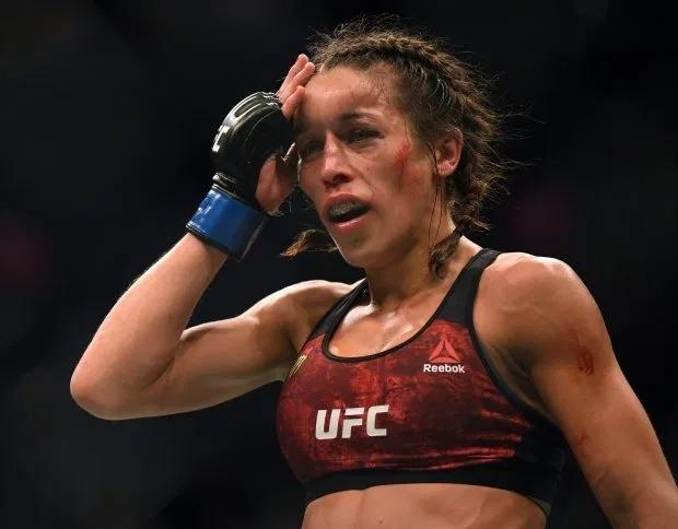 乔安娜被打得"毁容",做整形手术以求二战_腾讯新闻