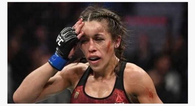 重拳出击后乔安娜立马做整形手术赛前的嚣张劲儿哪去了