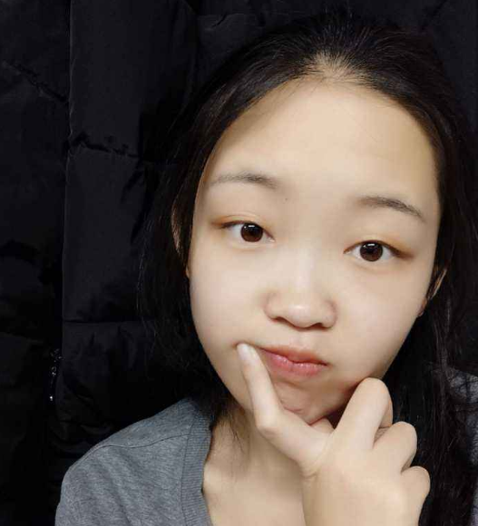 青春期最"糟蹋"颜值的3陋习,全中的会变丑,学生党趁早了解!