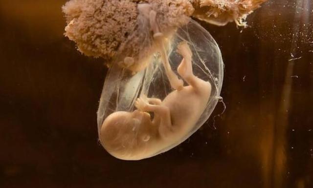 孕妈的这几个坏习惯正在让羊水变浑浊32周前弥补来得及