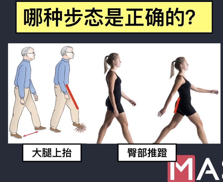 小腿粗和走路姿勢有關係嗎?