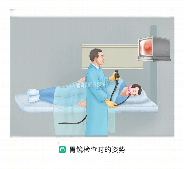 胃镜检查很恐怖?别慌,本文带你揭开胃镜的"神秘面纱",注意这4点很关键