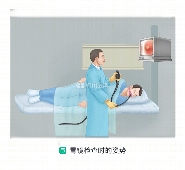 受检者首先要采取以下体位配合检查,并在检查中根据医生要求尽量保持