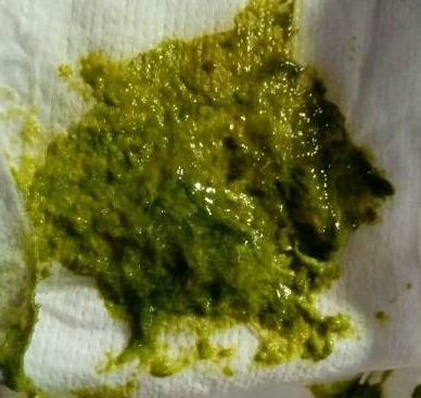 作为一个专业且敬业的"鉴屎"宝妈,常常会发现自己的宝宝拉绿色粑粑,喂