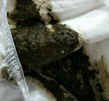 宝宝拉绿便就是奶粉的"锅"?饥饿,辅食……这些都可能,附图干货拿去!