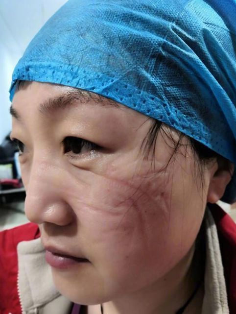 河北医大一院供图 3月10日, 今年38岁的 刘丽从业已经16年了, 在新冠
