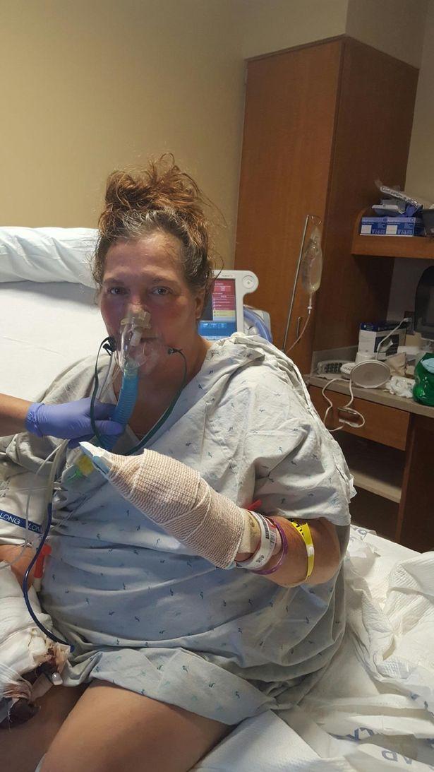 美国53岁女子因患败血症导致双手双脚都被截肢后她学会了跳伞和潜水