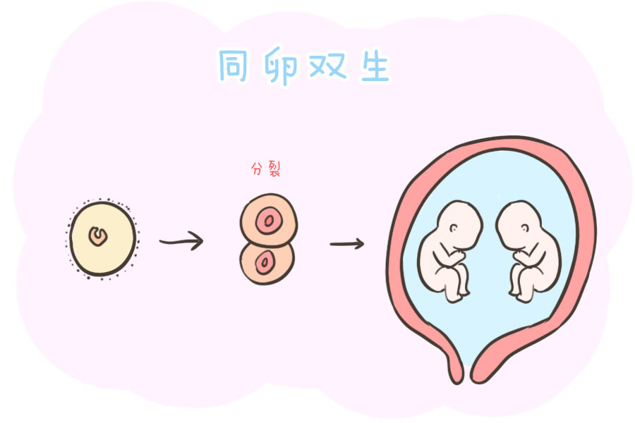 异卵双胞胎是什么图片