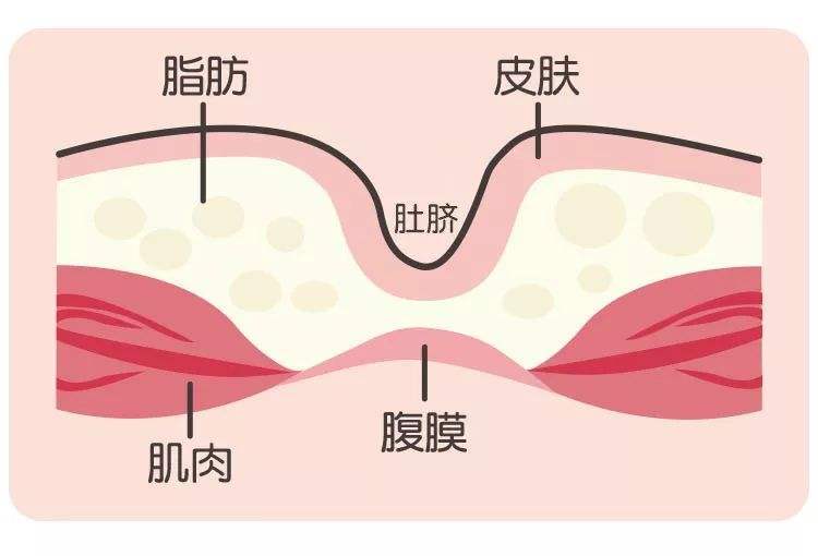 它不过是你肚子上的一个上了锁的门,门后面是一条死路,其实并不连着