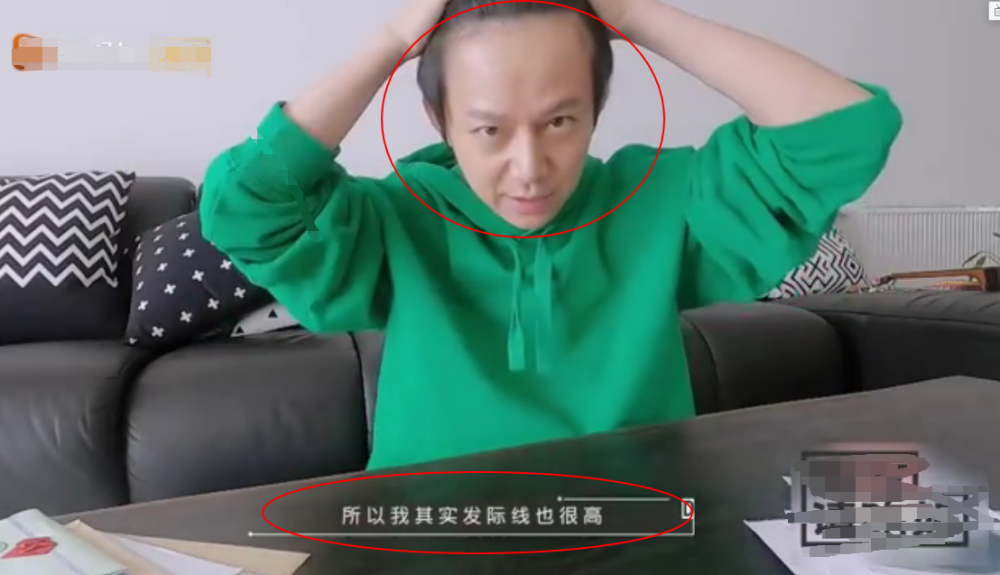 何炅节目中掀起刘海,发际线高得吓人,不老神话破灭!