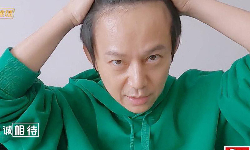何炅展示发际线这大脑门和和杨幂有的一拼明星的发量是个谜
