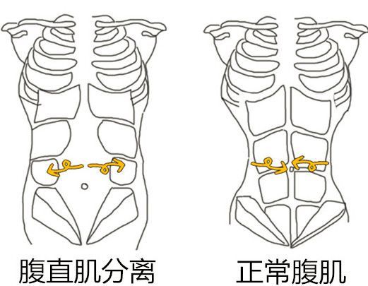 新世纪妇儿最全产后问题讲解脱发便秘盆底损伤腹直肌分离