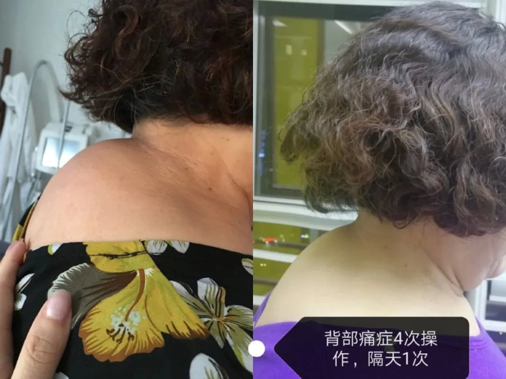 看法国lpg如何以一敌百(下)