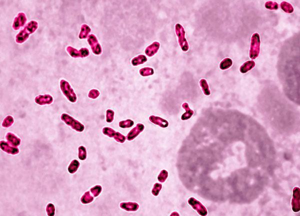 耶尔森氏鼠疫杆菌(来源:健康无忧网)罗局长收到耶尔森让人送来的巴氏