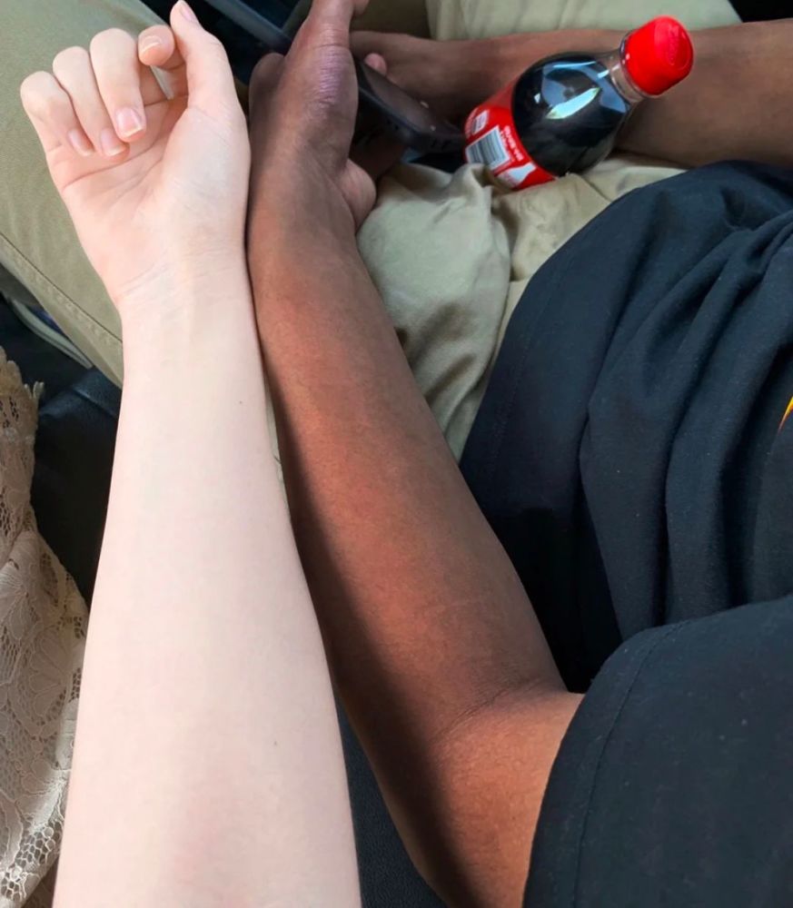 美白大作战 做到这几点 让你重新白到脚 曙光健康网