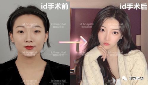 在韩国一般做全脸整容多少钱 万够吗 10万可以整成什么样 腾讯新闻