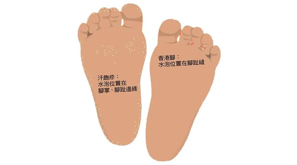 真痒啊!北京儿童医院专家助您打赢孩子春季皮肤保卫战!