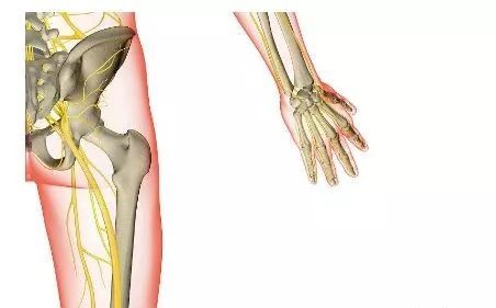 80腰腿痛都与这个肌肉有关系
