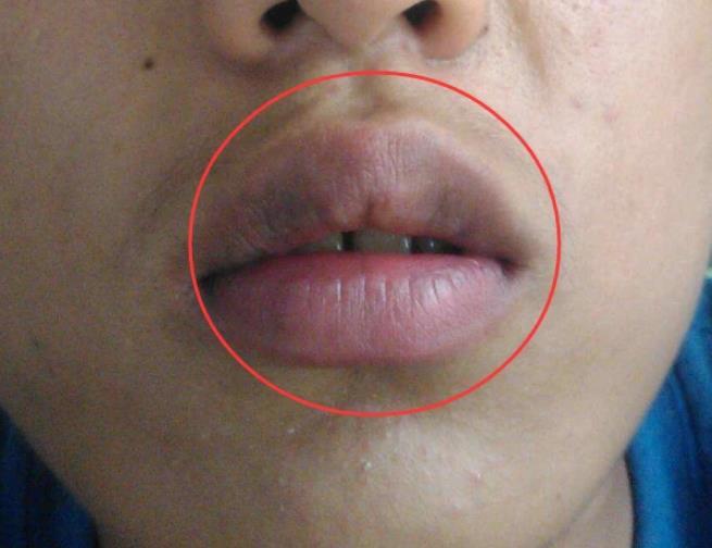 公认最丑的3大唇形让你知道什么叫做一张嘴毁掉整张脸