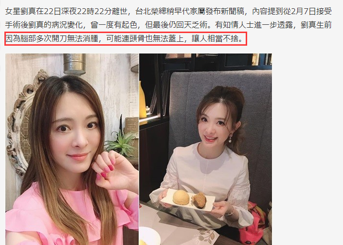 刘真生前最后状况曝光,知情人称脑部开刀肿胀:最坏时头骨都盖不上
