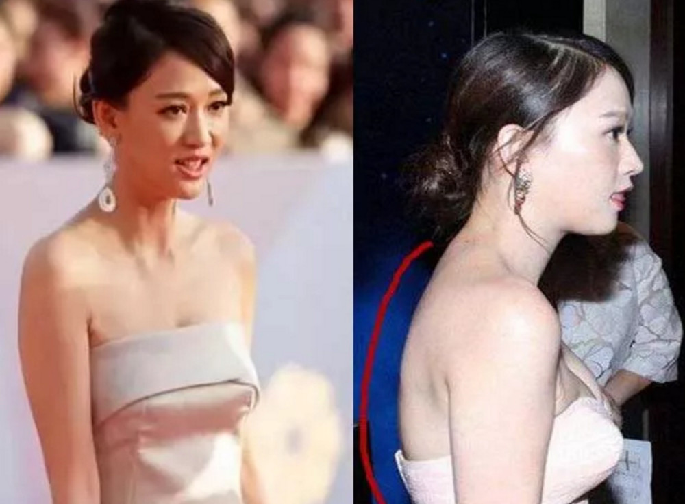 1,含胸驼背显矮:含胸,上半身前倾弯曲两肩向前窝,是脊柱正常生理弯曲