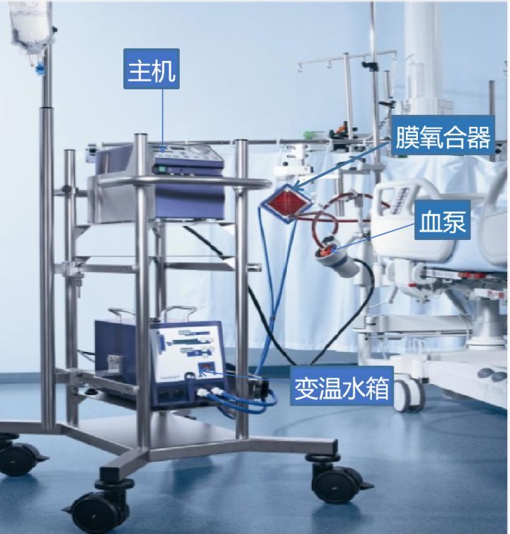 在此强调,体外膜肺氧合是有限稀缺医疗资源.