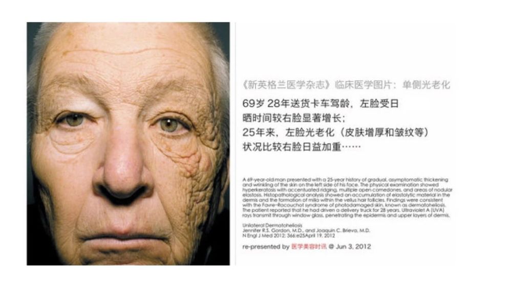 英国bbc纪录片的驻颜奥秘认清防晒的真相 腾讯新闻