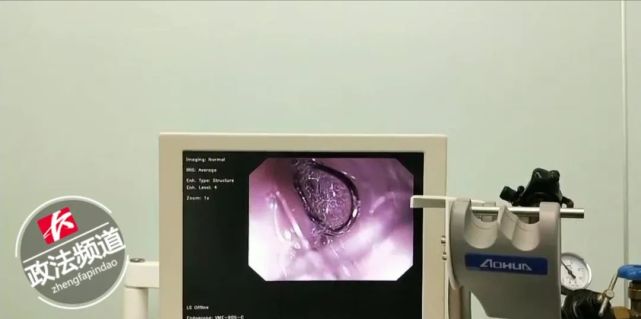 医生用内窥镜为狗狗手术.