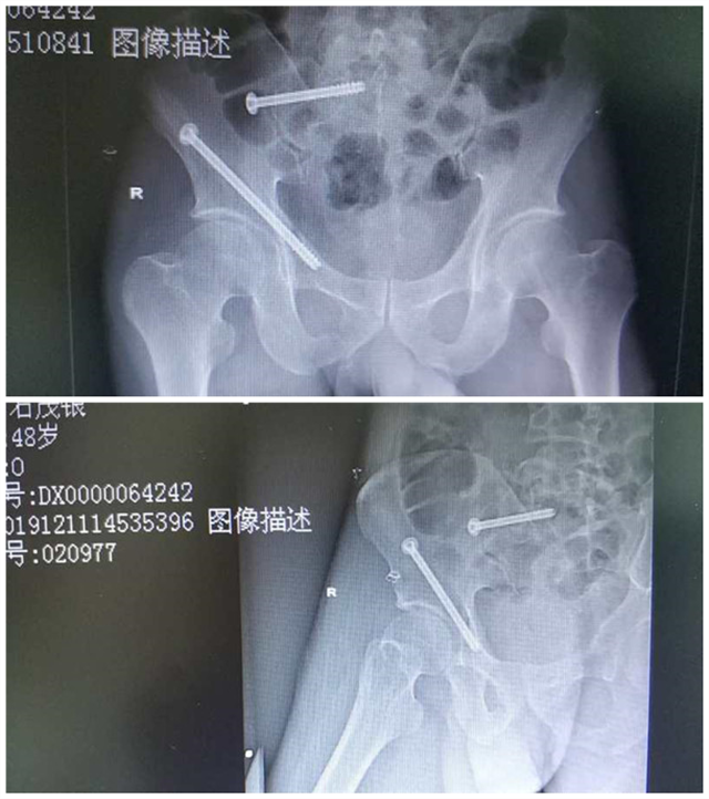 腾讯内容开放平台