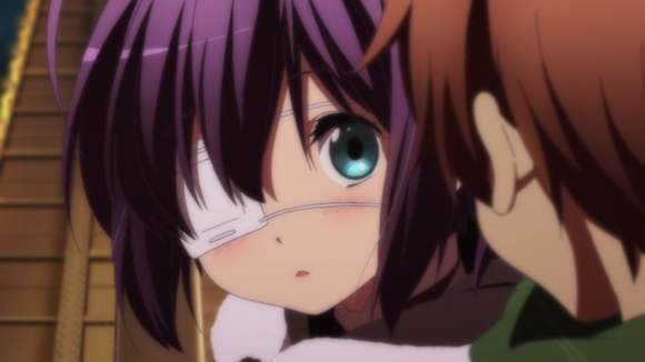 动漫中的可爱独眼少女她们拥有傲娇卖萌属性