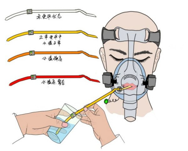 上海护士的一个小发明 让重症患者戴着呼吸机也能方便喝水