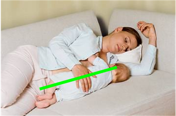 保证乳头通畅,尽早泌乳;其次喂奶时,要使用正确的含接姿势(下颌贴乳房