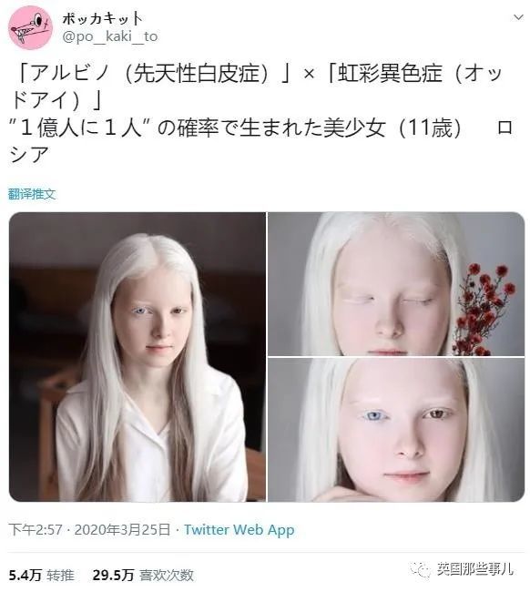 白化病×虹膜异色症,1亿分之1概率出生的11岁俄罗斯少女