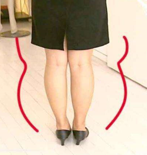 来看下下面对比图的跟腱部分和圈起来的腓肠肌部分,即使大家胖瘦差不